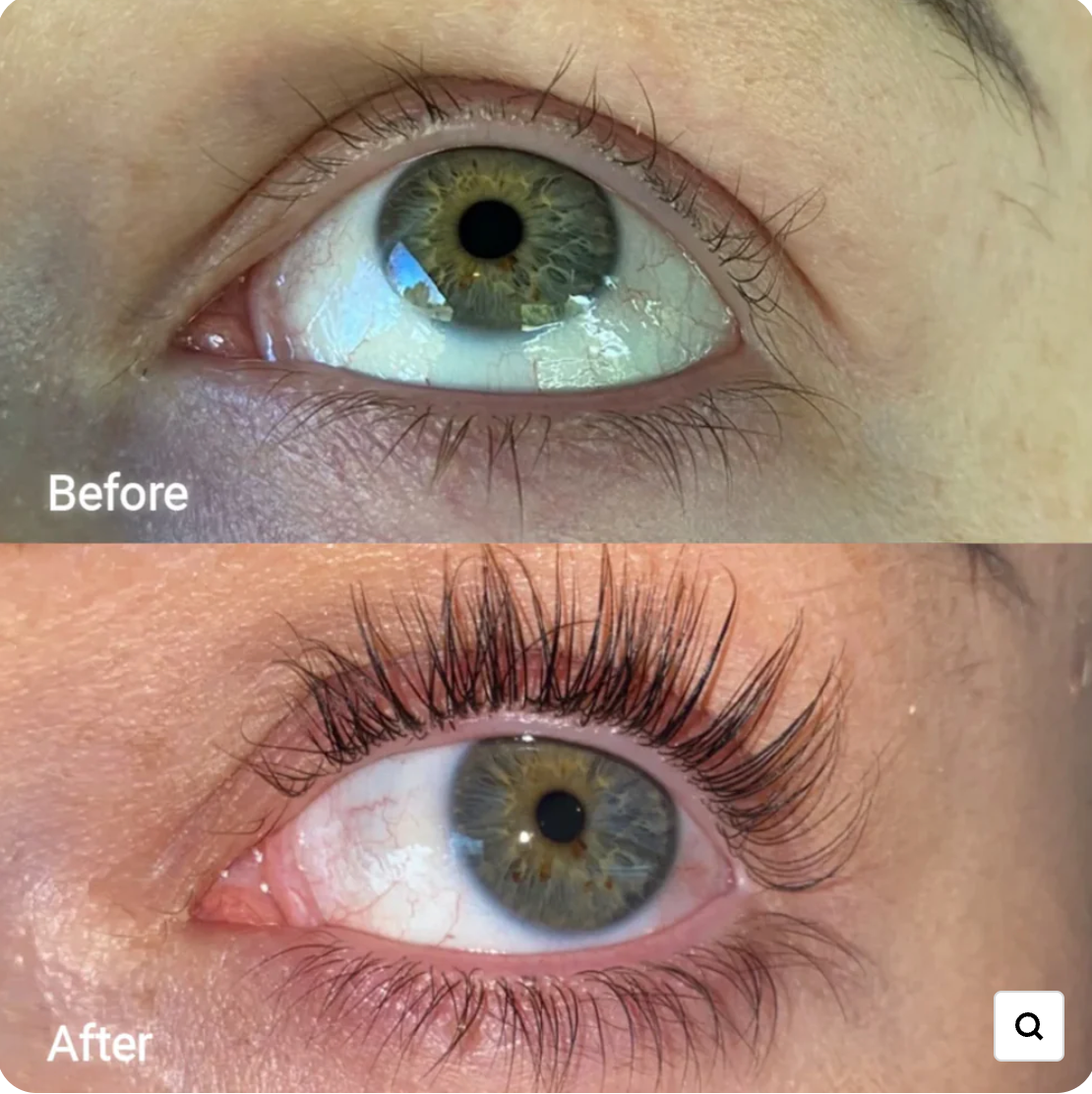 EYECONIC™ Eyelash Growth Serum